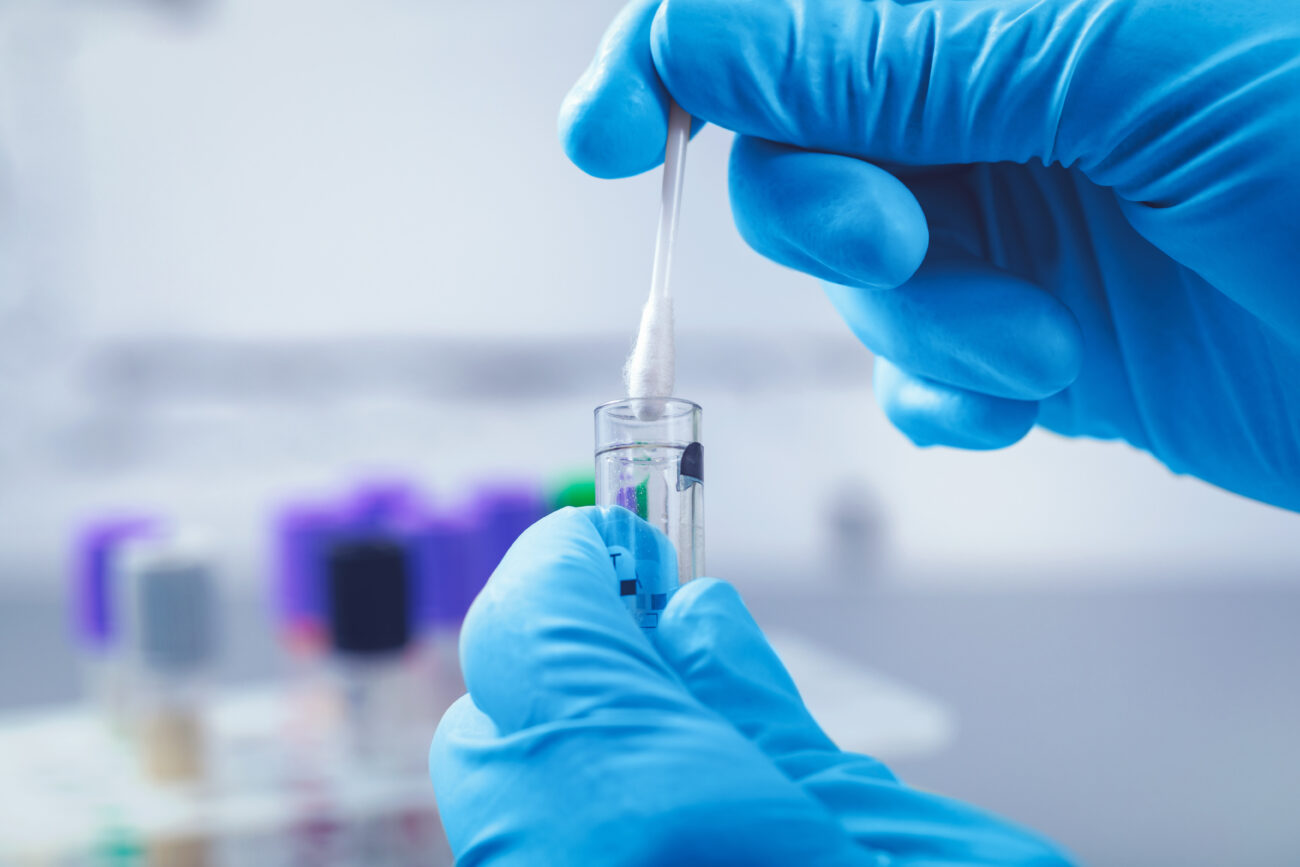 scientist in lab collect dna sample in test tube with cotton swa
